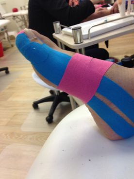 Medical taping